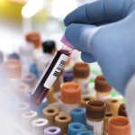 Royal Philips, Ibex Medical Analytics broaden partnership for pathology diagnostics