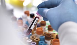 Royal Philips, Ibex Medical Analytics broaden partnership for pathology diagnostics