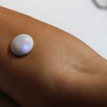 Biolinq raises 0M for intradermal glucose sensor for sort 2 diabetes