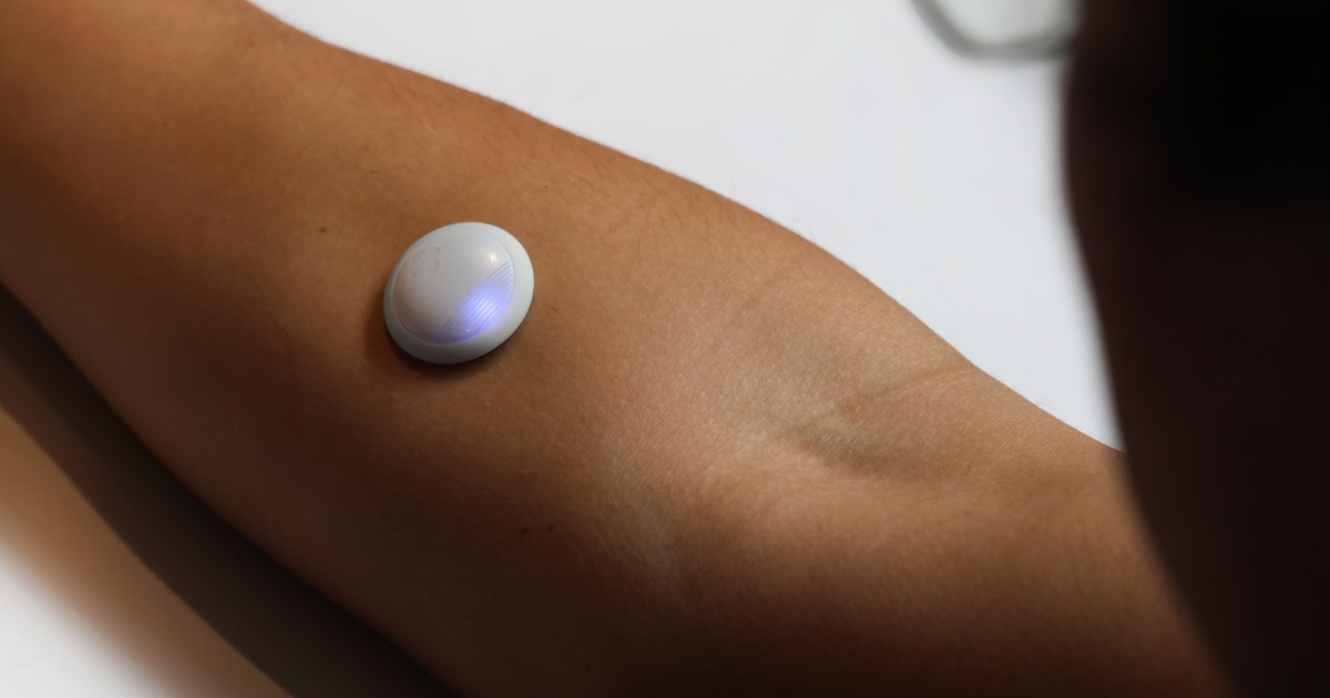 Biolinq raises 0M for intradermal glucose sensor for sort 2 diabetes