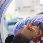 Chipiron raises M for miniature MRI prototype