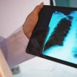 Viz.ai companions with Regeneron, Sanofi to review COPD software