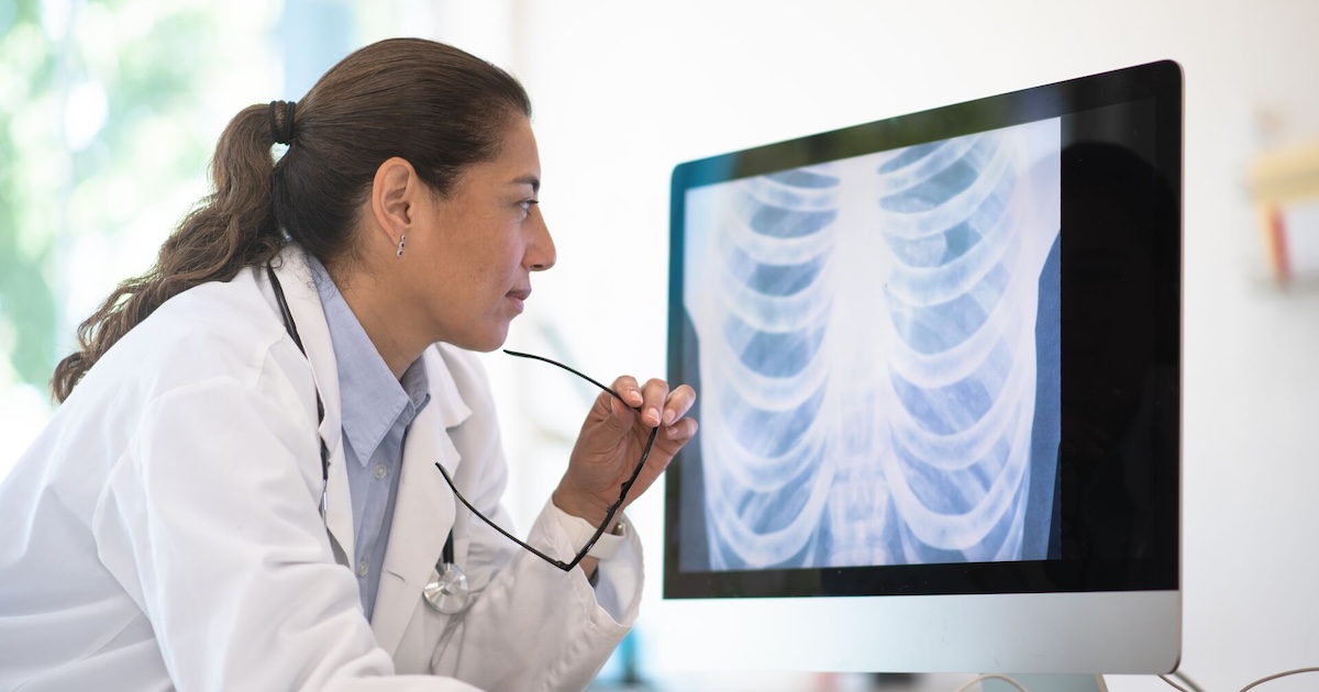 Queensland analysis growing wearable X-ray for youths and extra briefs